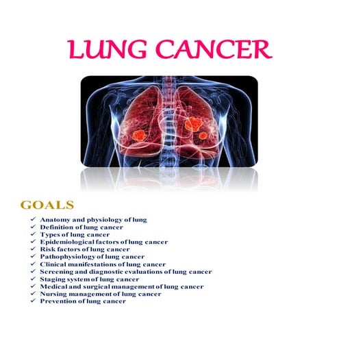 Lung cancer