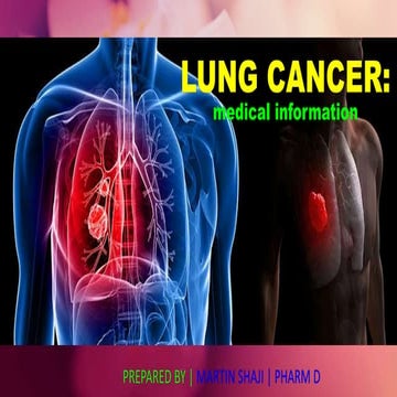 Lung cancer-medical discussion | study 