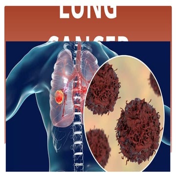 LUNG CANCER LUNG CLINICAL MANIFESTATION TREATMENT