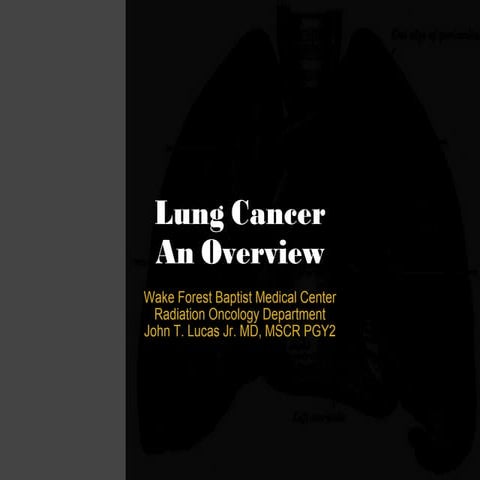 Lung cancer overview-JTL