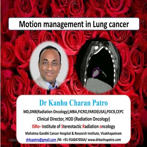 MOTION MANAGEMANT IN LUNG SBRT BY DR KANHU CHARAN PATRO
