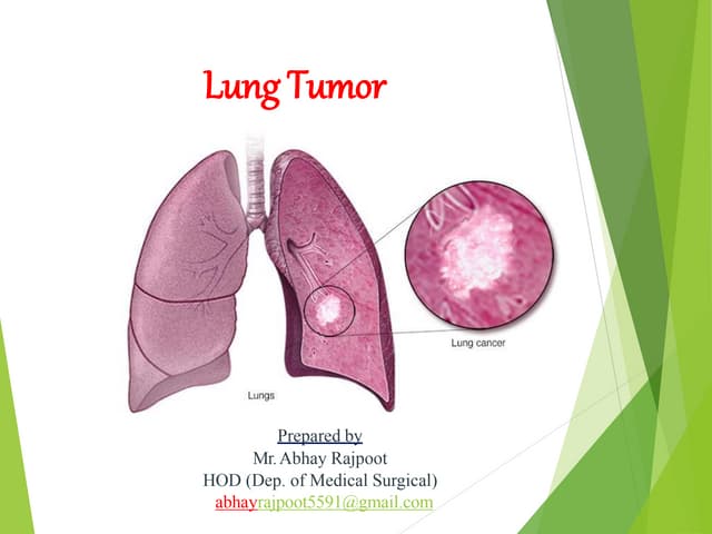 Lung cancer