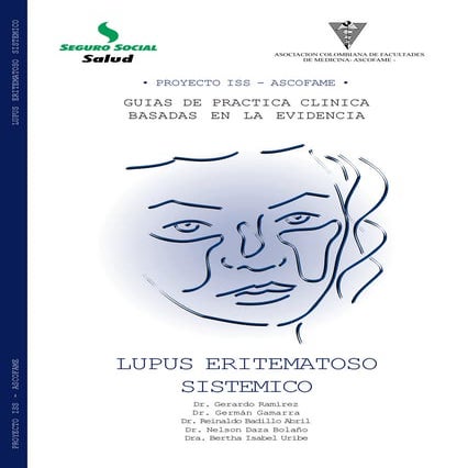 Lupus