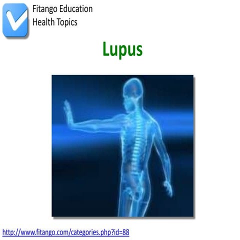 Lupus | PPTX