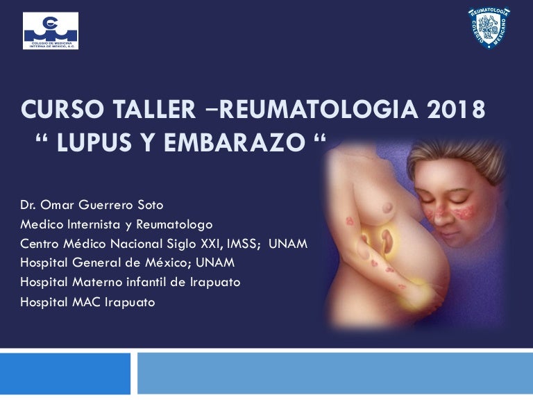 lupus es más probable diabetes gestacional lupus es más probable diabetes gestacional