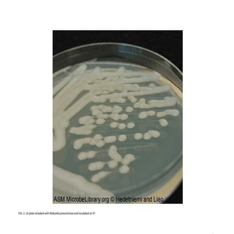 luria-broth-lb-luria-agar-la-media-and-their-uses-klebsiella-pneumonia.pptx