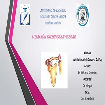 Luxacion articulacion esternoclavicular