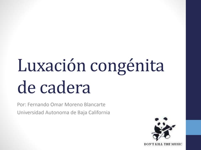 Luxacion congenita de cadera
