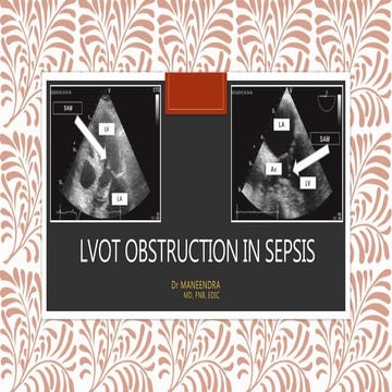 LVOT OBSTRUCTION IN ICU PPTX Heart And Cardiovascular Diseases 