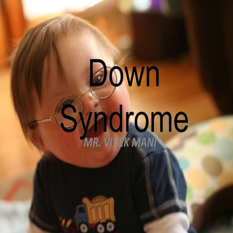  DOWNS SYNDROME  (PPT)