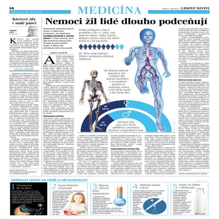 Nemoci žil lidé dlouho podceňují | Lidové noviny