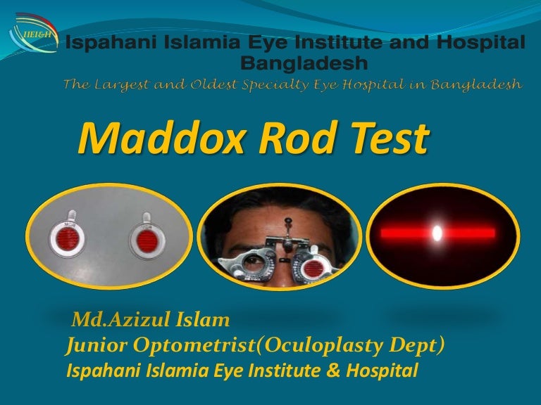 Maddox Rod test