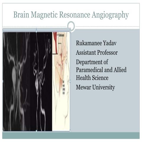 Magnetic Resonance Imaging Brain (MRA).pptx,umour,  Metastases   Cranial nerv...