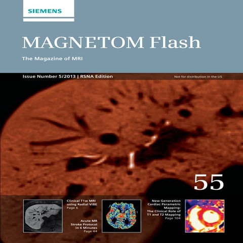 Magnetom flash 55