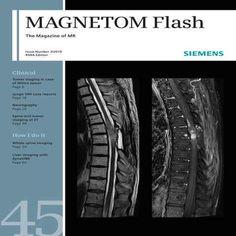 Magnetom flash 45