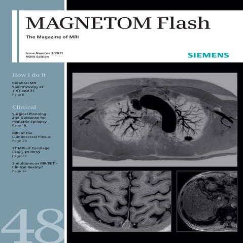 Magnetom flash *SIEMENS*