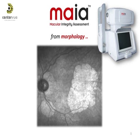 MAIA microperimetry centervue 100809