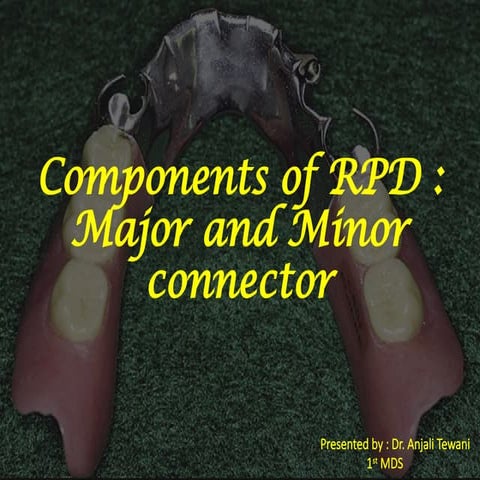 Maxillary major connectors | PPTX