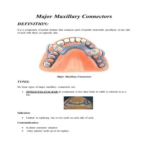 Major Maxillary Connectors