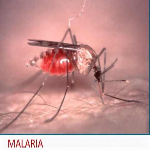 Malaria  . dr surya