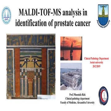 Maldi tof-ms analysis in identification of prostate cancer
