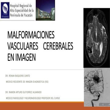 Malformaciones arterio venosas cerebrales