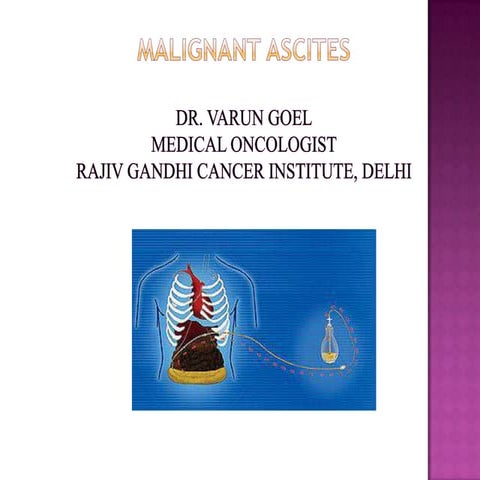 Malignant ascites dr. varun