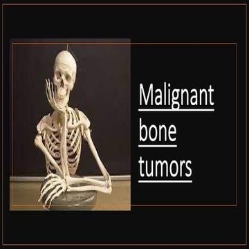 Malignant bone tumors