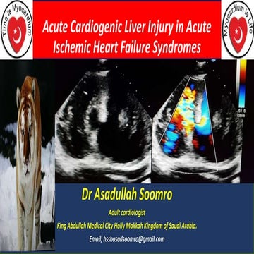 Acute cardiogenic Liver injury & Malignant heart failure Syndromes | PPTX