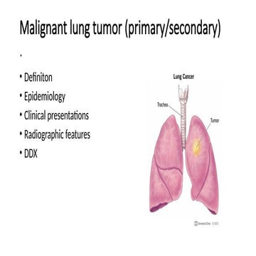 Comprehensive Overview of Malignant Lung Tumors: Diagnosis and Clinical ...