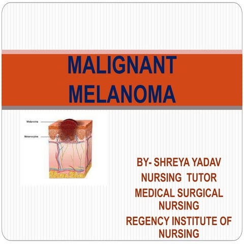 Malignant Melanoma.pptx