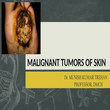 Skin cancers | PPTX