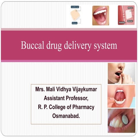 Buccal Drug Delivery System Mali vv ppt