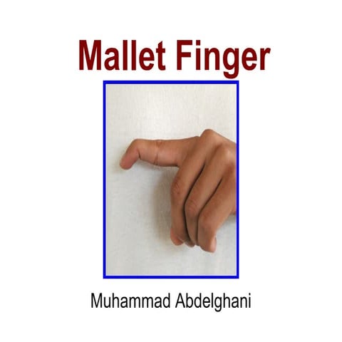 Mallet finger