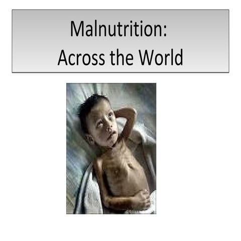 Malnutrition