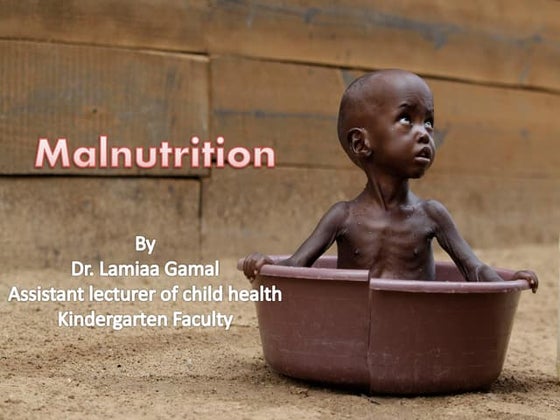 Malnutrition consequences, causes, prevention and control