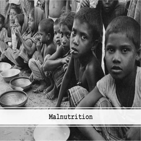 Malnutrition (A global problem)