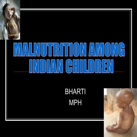 Malnutrition Among Indian Children | PPT