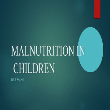 Malnutrition  in  children by Dr. R Mano