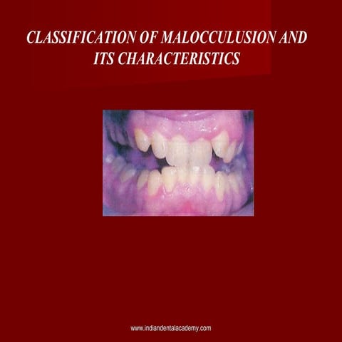 Malocclusion