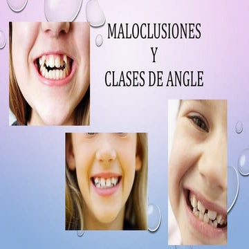 Maloclusiones