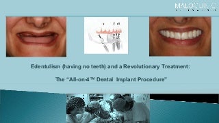Edentulism & Revolutionary Treatment :- The "All-on-4" Dental Implant Procedure