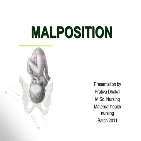 Malposition