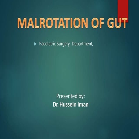 Malrotation | PPTX