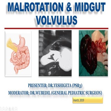 MALROTATION & MIDGUT VOLVULUS final.pdf