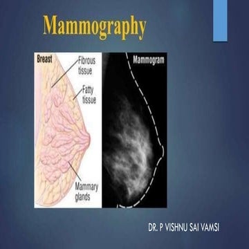 Mammography presentation | PPT