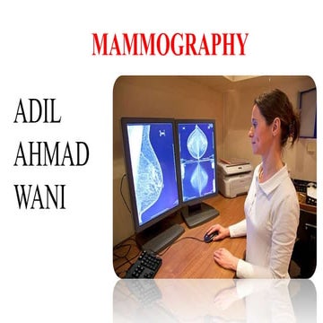 MAMMOGRAPHY VIEWS .ppt