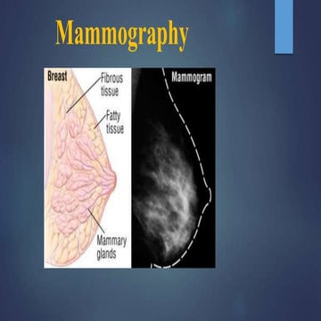 mammographyfull radiology as described in rsna