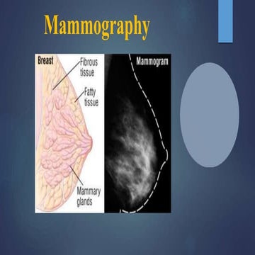 mammographyfull-210721111323 (1).pptx