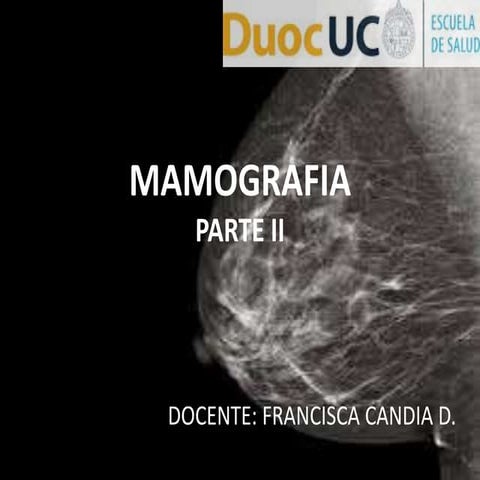 MAMOGRAFIA2PARTE.ppt